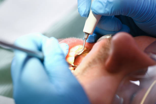 Best Emergency Dental Services for Seniors in Ocean View, DE